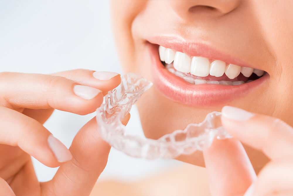 Invisalign