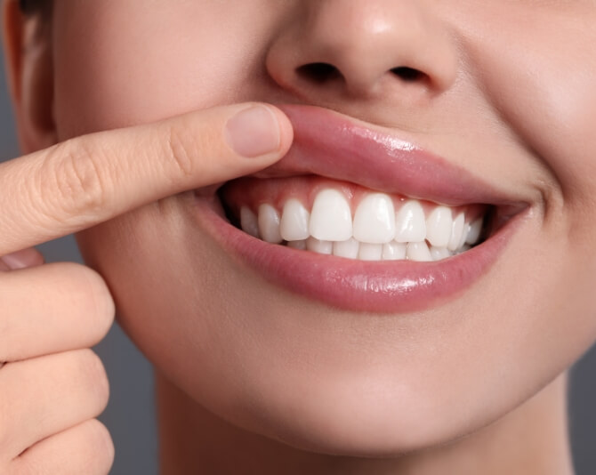 Periodontics