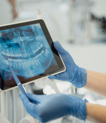 Gloved hands holding a tablet displaying a dental X-ray image of teeth and jaw.