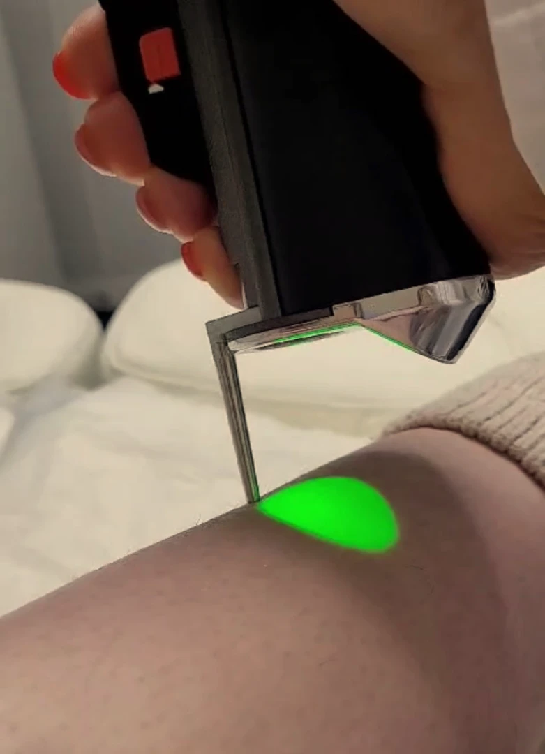 Hand holding a device emitting a green light on a person's forearm, likely for a laser treatment or skin scanning.