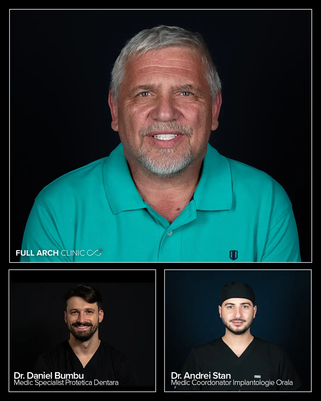 pacient cu allon6 bimaxilar cu dr Andrei Stan