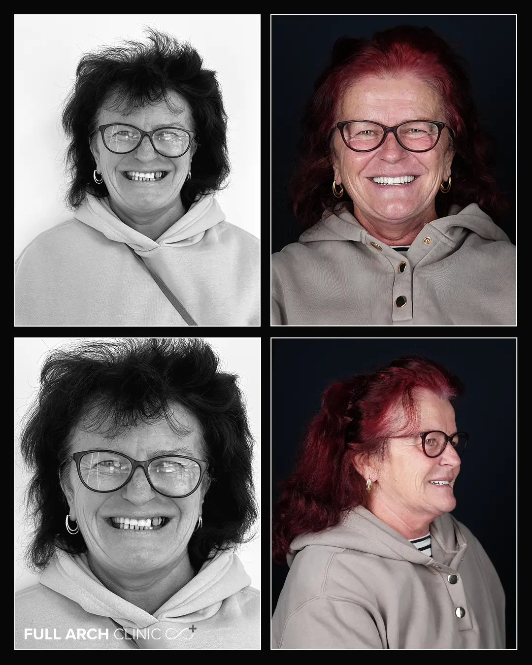 Diferență majoră între situația inițială și rezultatul final.