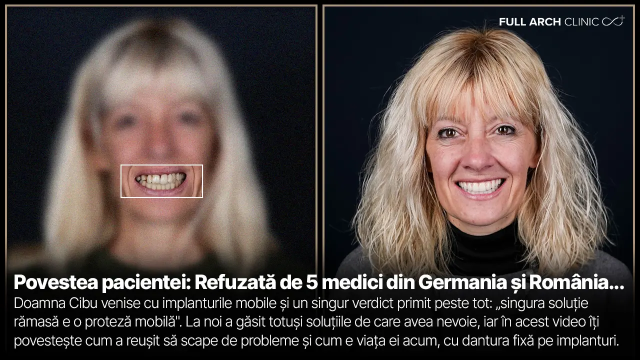 Doamna Cibu alături de Dr. Andrei Stan — testimonial reabilitare pe 11 implanturi | Full Arch Clinic
