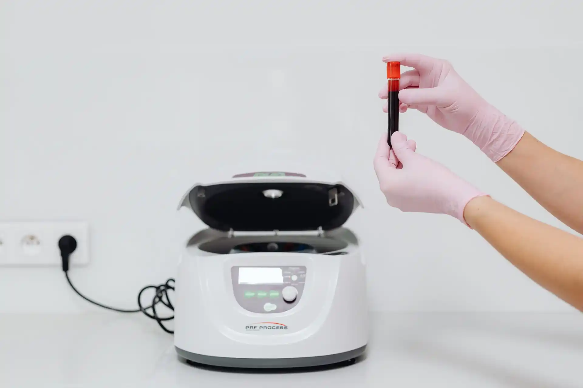 Platelet-Rich Plasma (PRP) Therapy