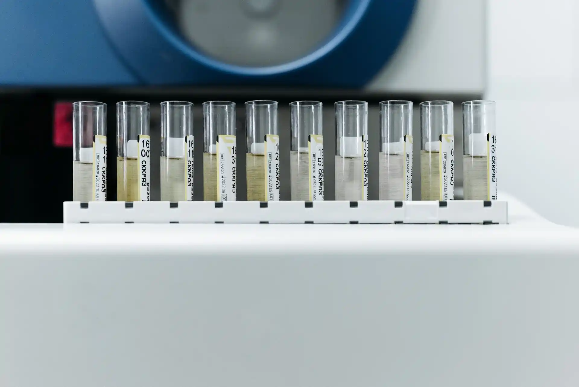 How Is Sperm DNA Fragmentation Tested?