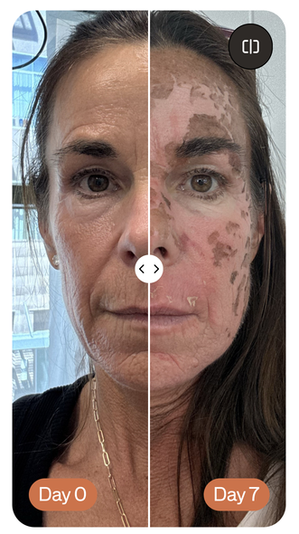 What should you expect during the "messy middle"?