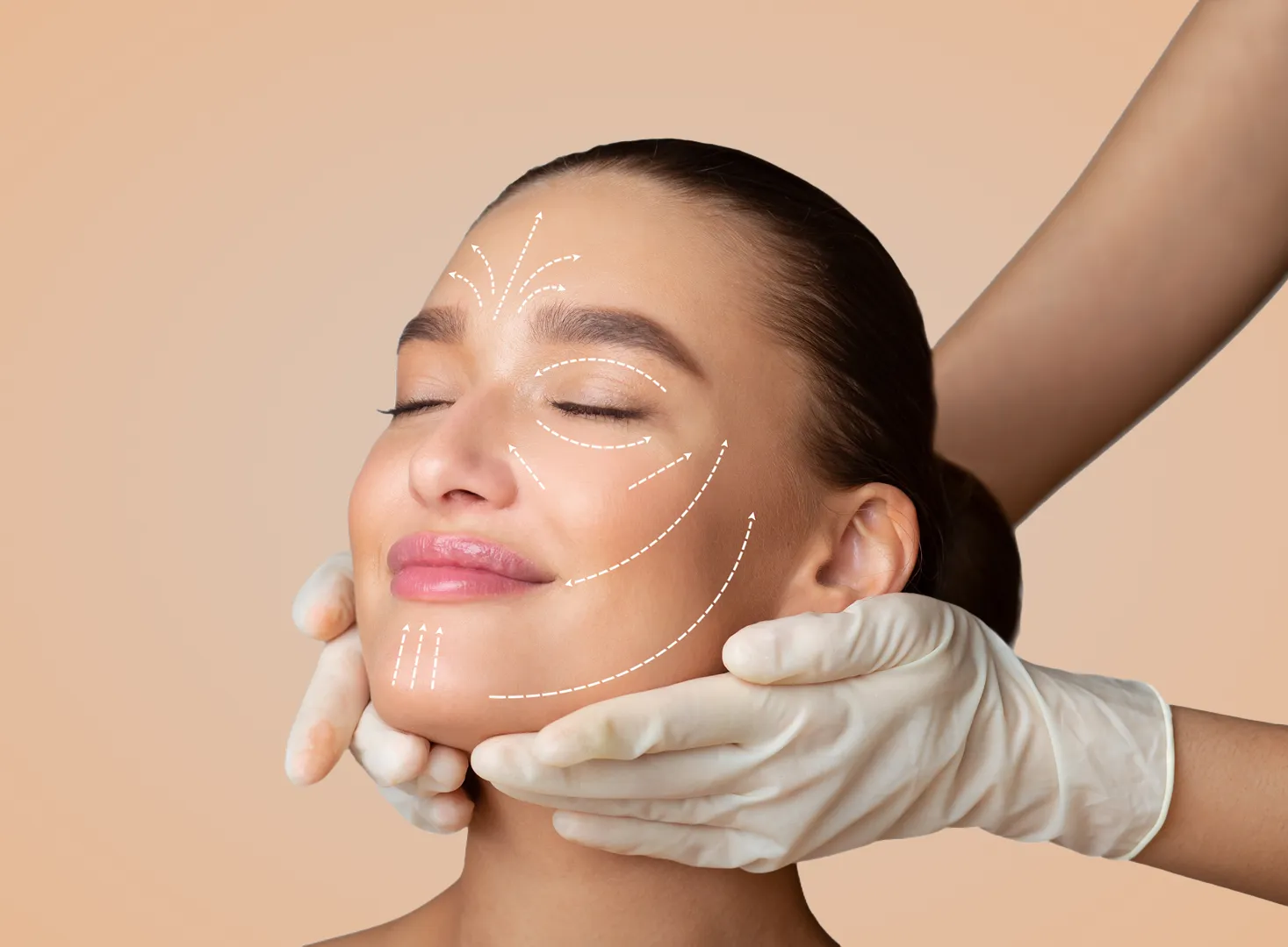 Cosmetic facial treatment with markings on a woman's face.