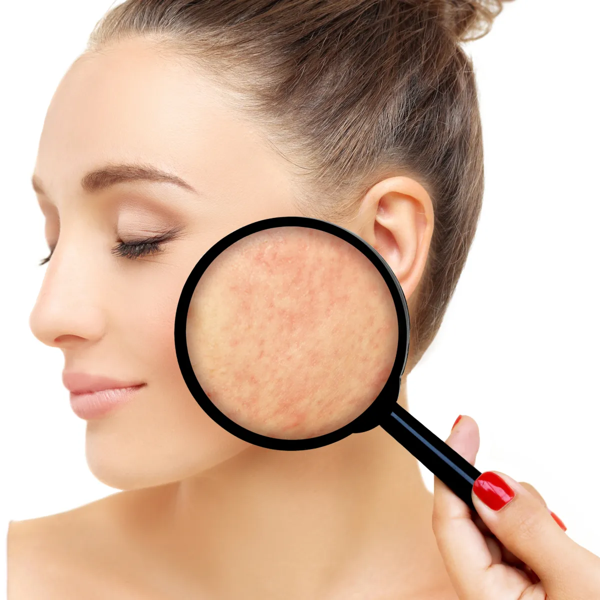 Close-up of a woman's skin under a magnifying glass, showing texture.