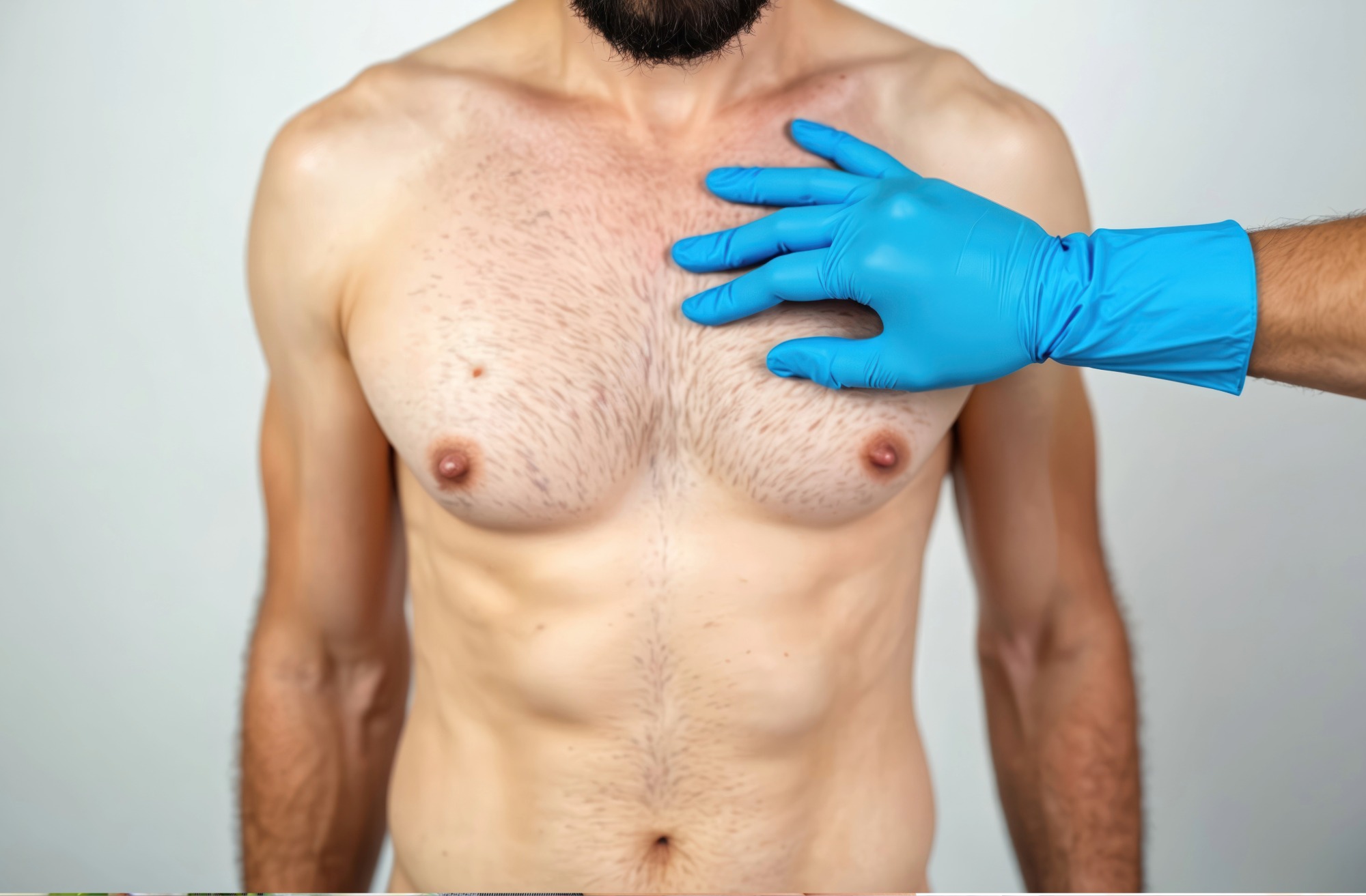 Close-up of a man's bare chest being examined by a hand wearing a blue medical glove.