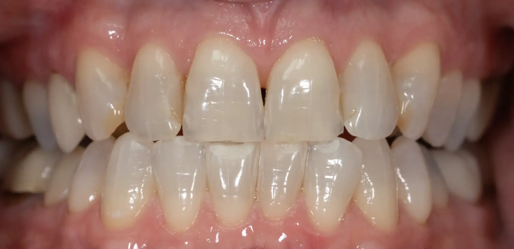 Before treatment
