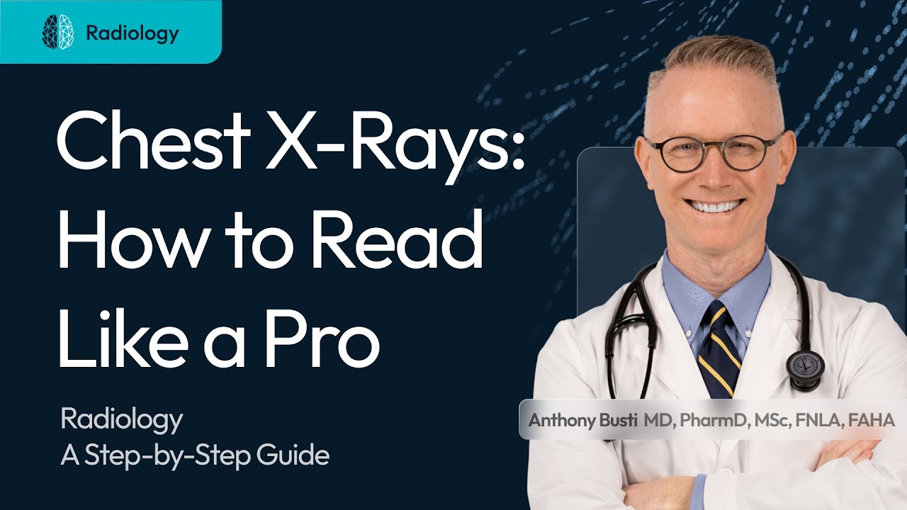Chest X-Rays: How to Read Like a Pro Thumbnail Image