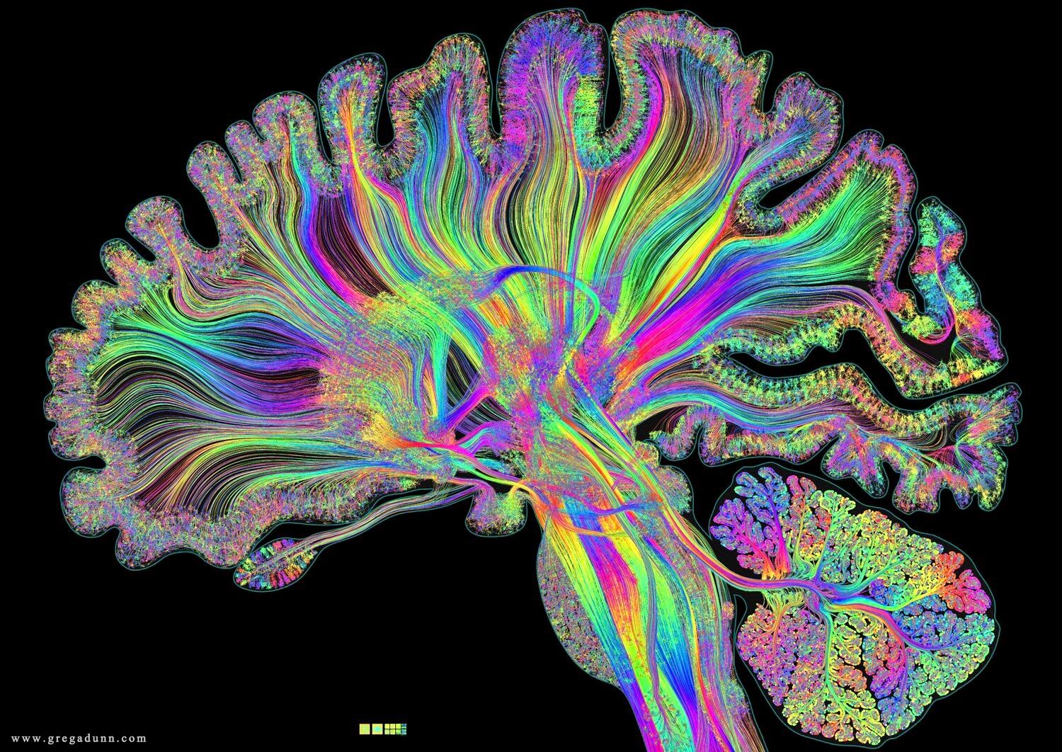 Zdravstvena.info on X: "#BRAIN 🧠 #FACTS - although this artwork contains ~500,000 neurons, the human brain contains ~86 billion #neurons, just as many non-neuronal support cells (glia), as well as ~100 trillion