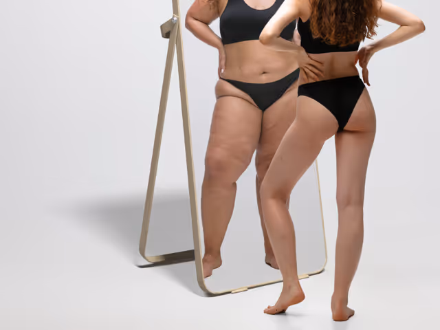 Schlanke Frau steht vor dem Spiegel und sieht darin kräftige Frau mit Lipödem