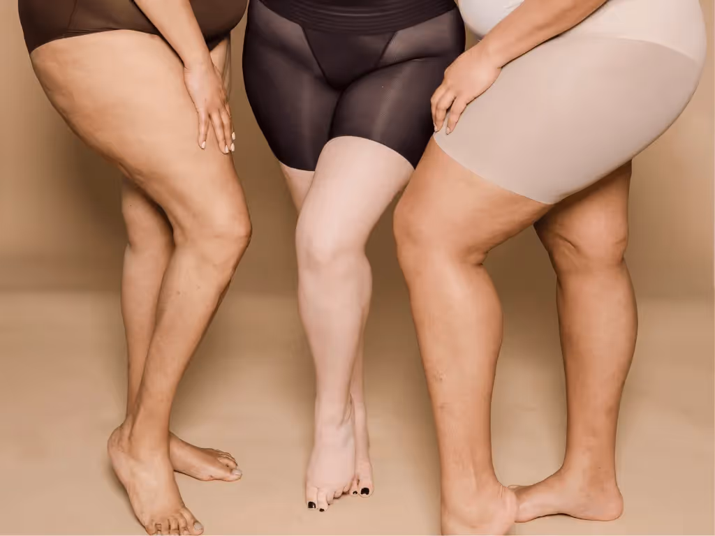 Drei Frauen mit kräftigen Beinen, die Spaß haben trotz Lipödem