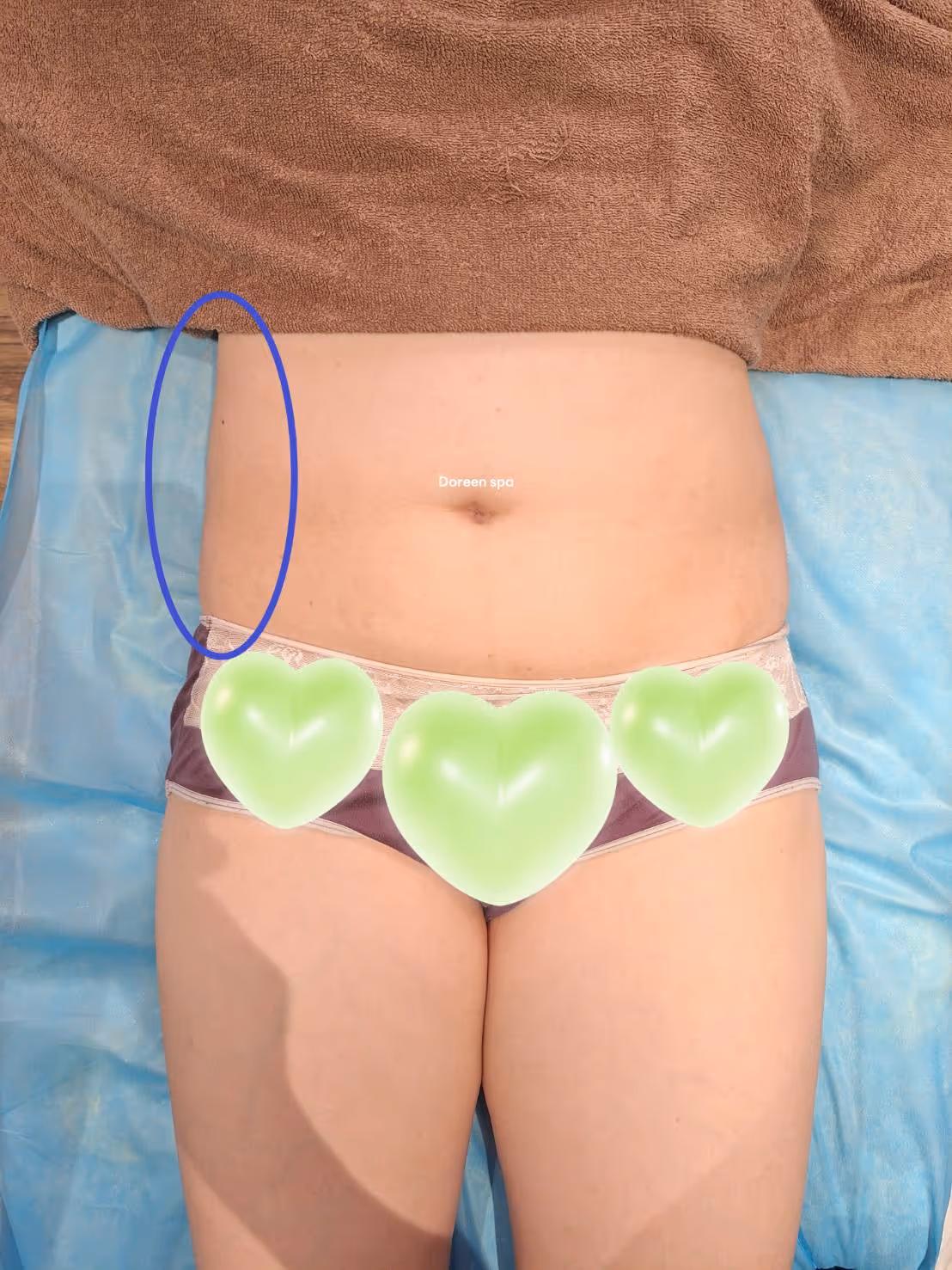 新竹孕婦按摩產後體態雕塑案例