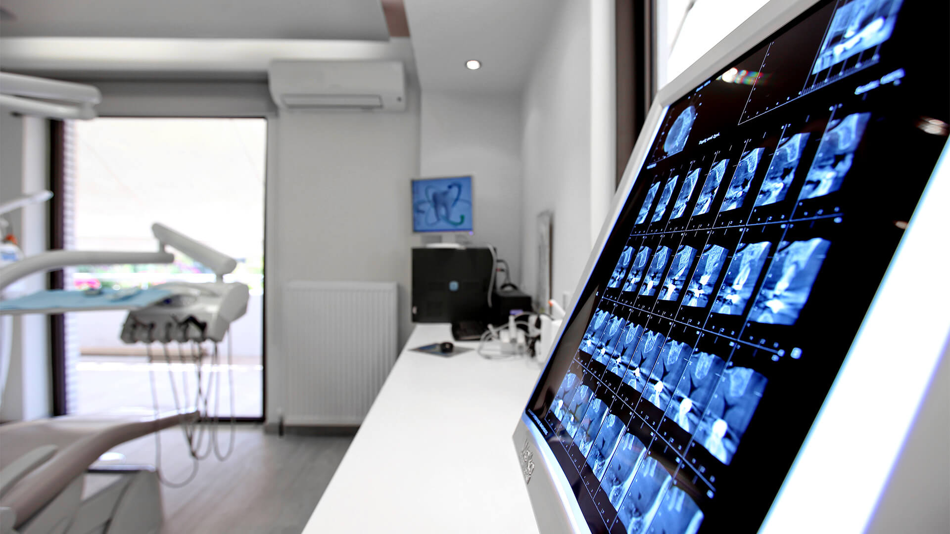 Close-up of a computer monitor displaying dental X-ray images in a modern dental office.