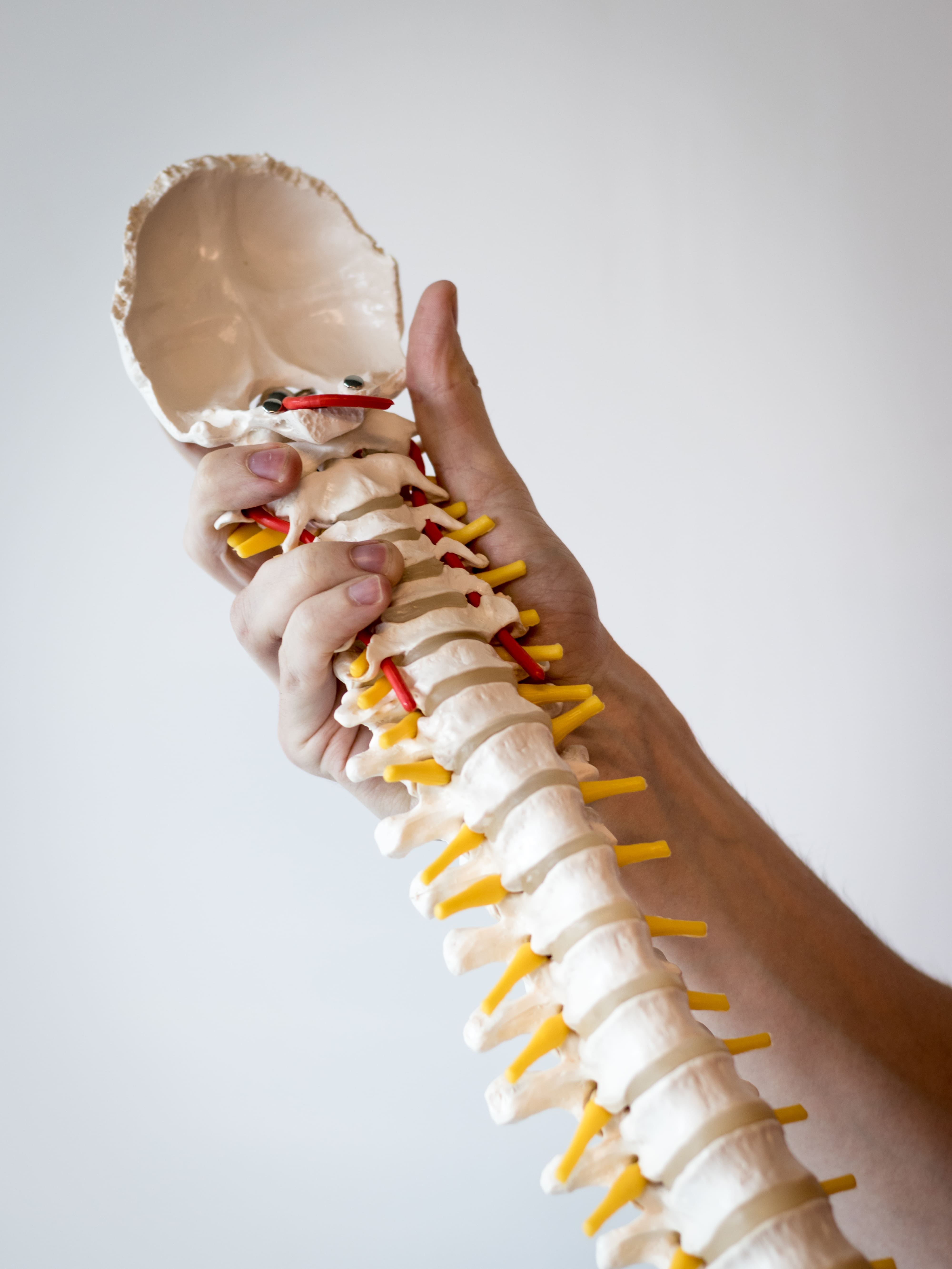 Hand houdt een anatomisch model van een menselijke wervelkolom vast met gele zenuwwortels en rode slagaders tegen een neutrale achtergrond.