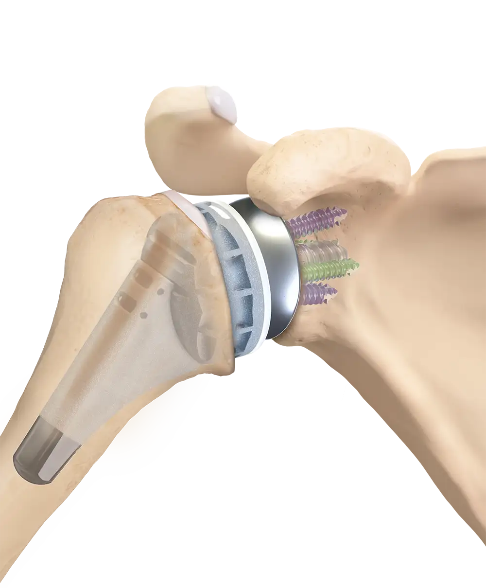 Graphic showing the finished Univers Revers™ joint in situ.
