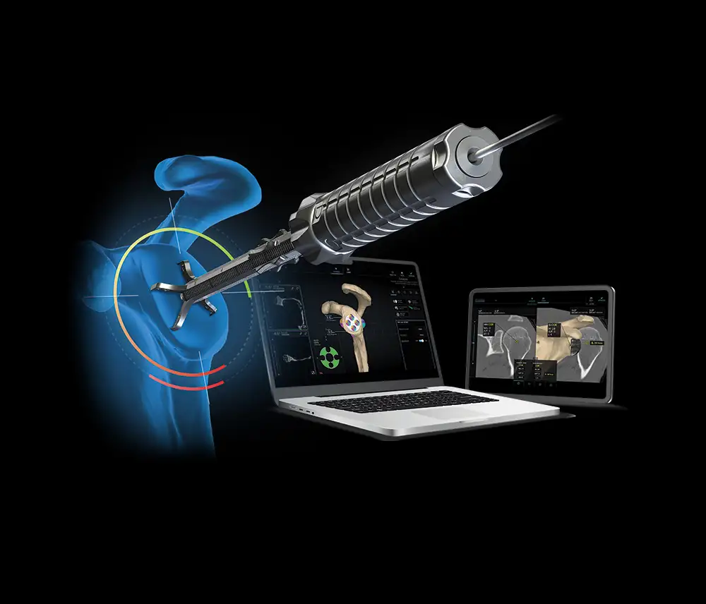 Laptop showing the Virtual Implant Positioning™ (VIP™) system software. Graphic of shoulder and guiding tool used by surgeons during shoulder replacement procedures.