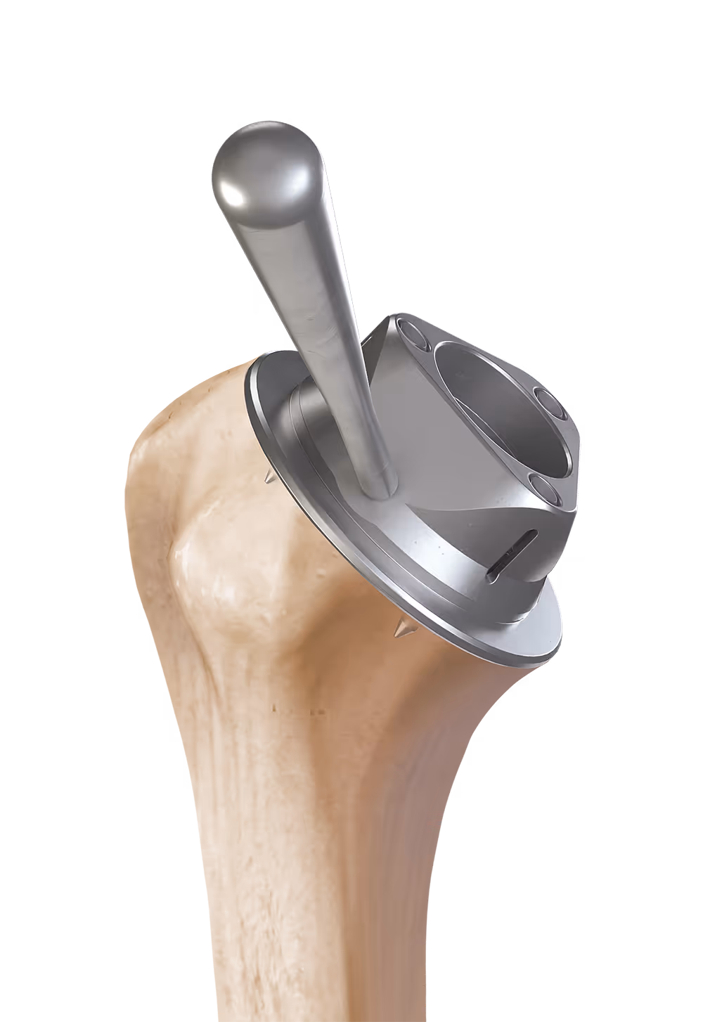 Cage screw being implanted in humerus with tool.