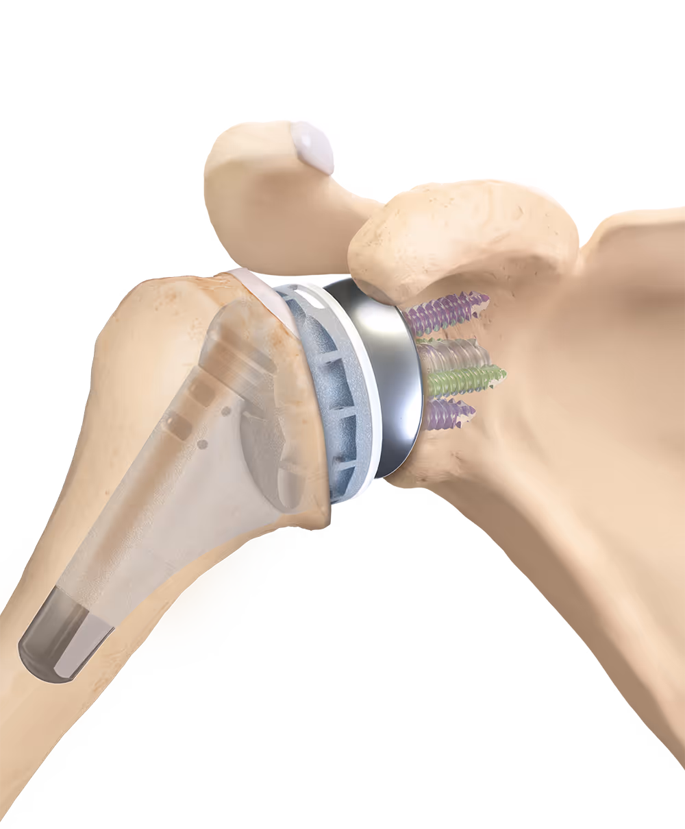 Graphic showing the finished Univers Revers™ joint in situ.