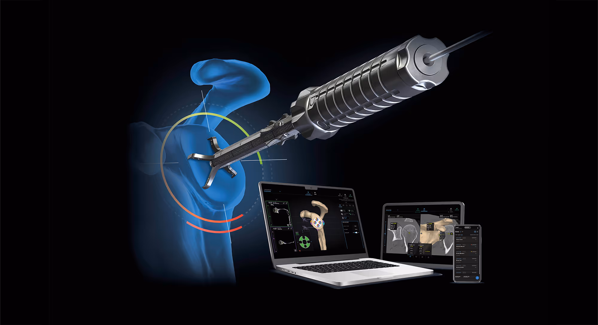 Laptop showing the Virtual Implant Positioning™ (VIP™) system software. Graphic of shoulder and guiding tool used by surgeons during shoulder replacement procedures.