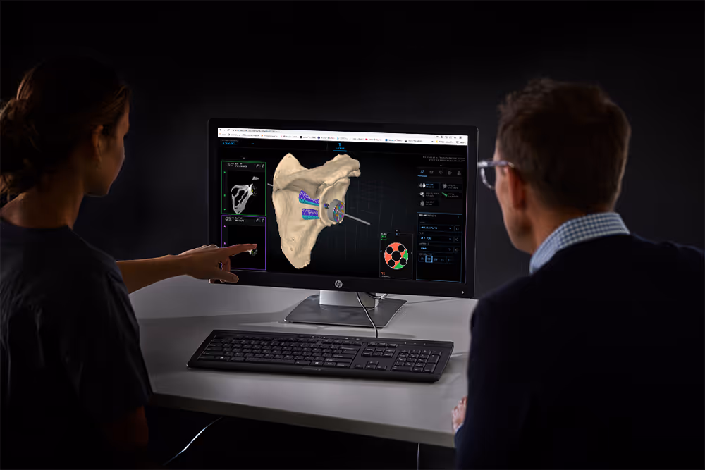 Two doctors looking at a computer that displays the anatomy of a human shoulder as part of preoperative planning. One doctor points to the computer screen while the other listens.