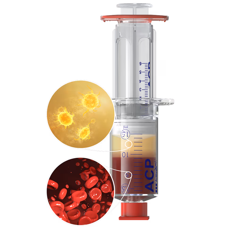 ACP Max PRP preparation system