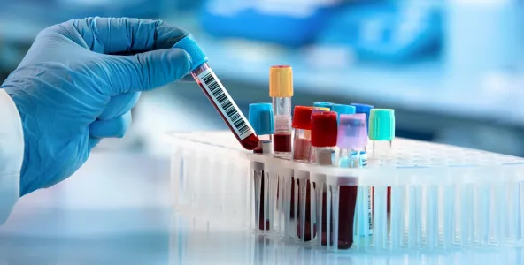 blood samples