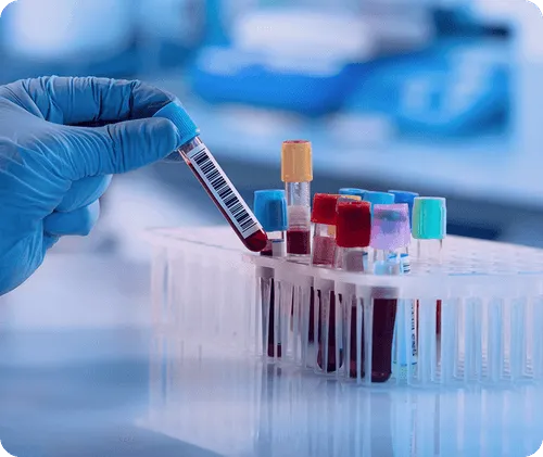 blood samples
