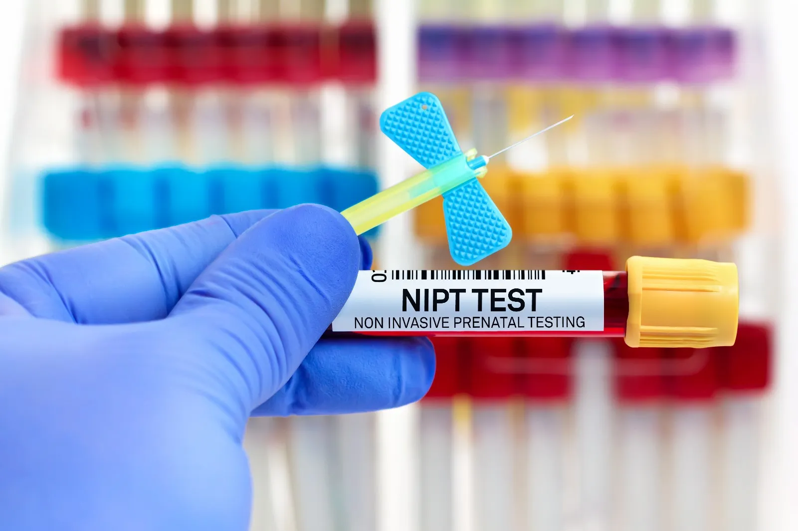 NIPT Test
