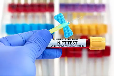 NIPT Test