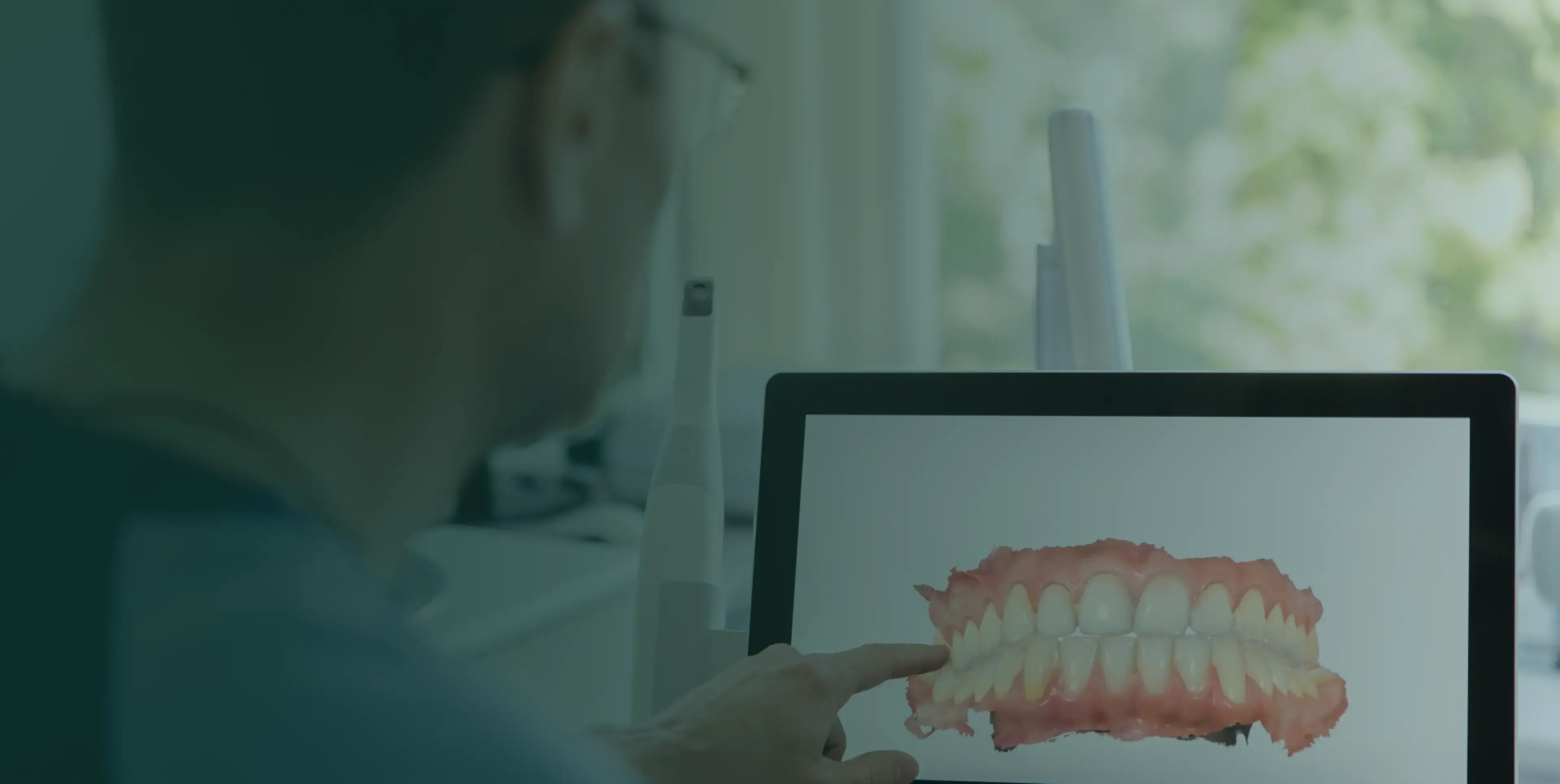 A person points at a 3D dental scan of teeth displayed on a computer screen.