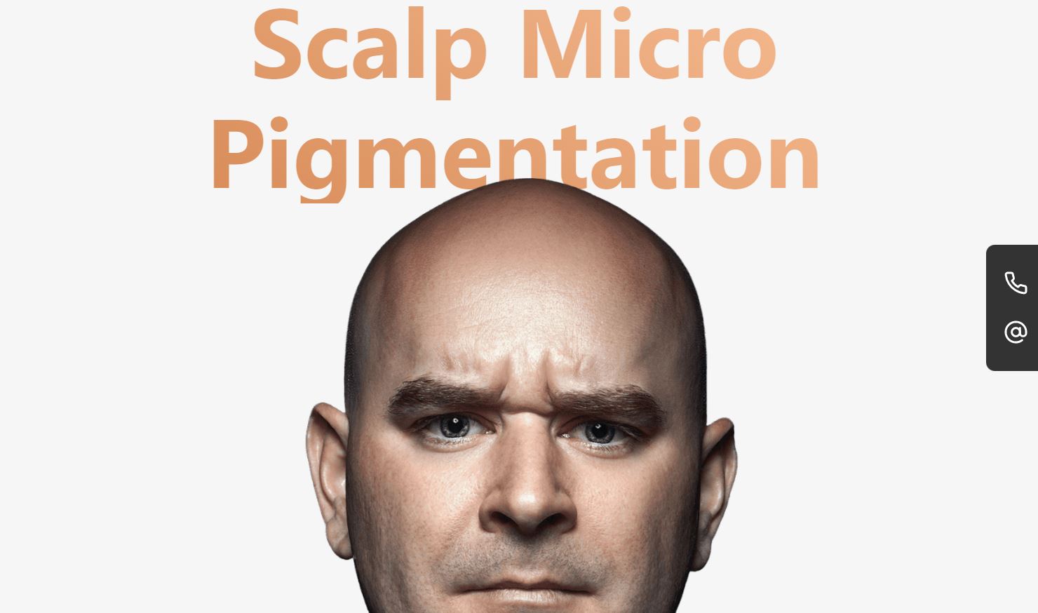 A bald man’s frowning face beneath the text “Scalp micro pigmentation.”