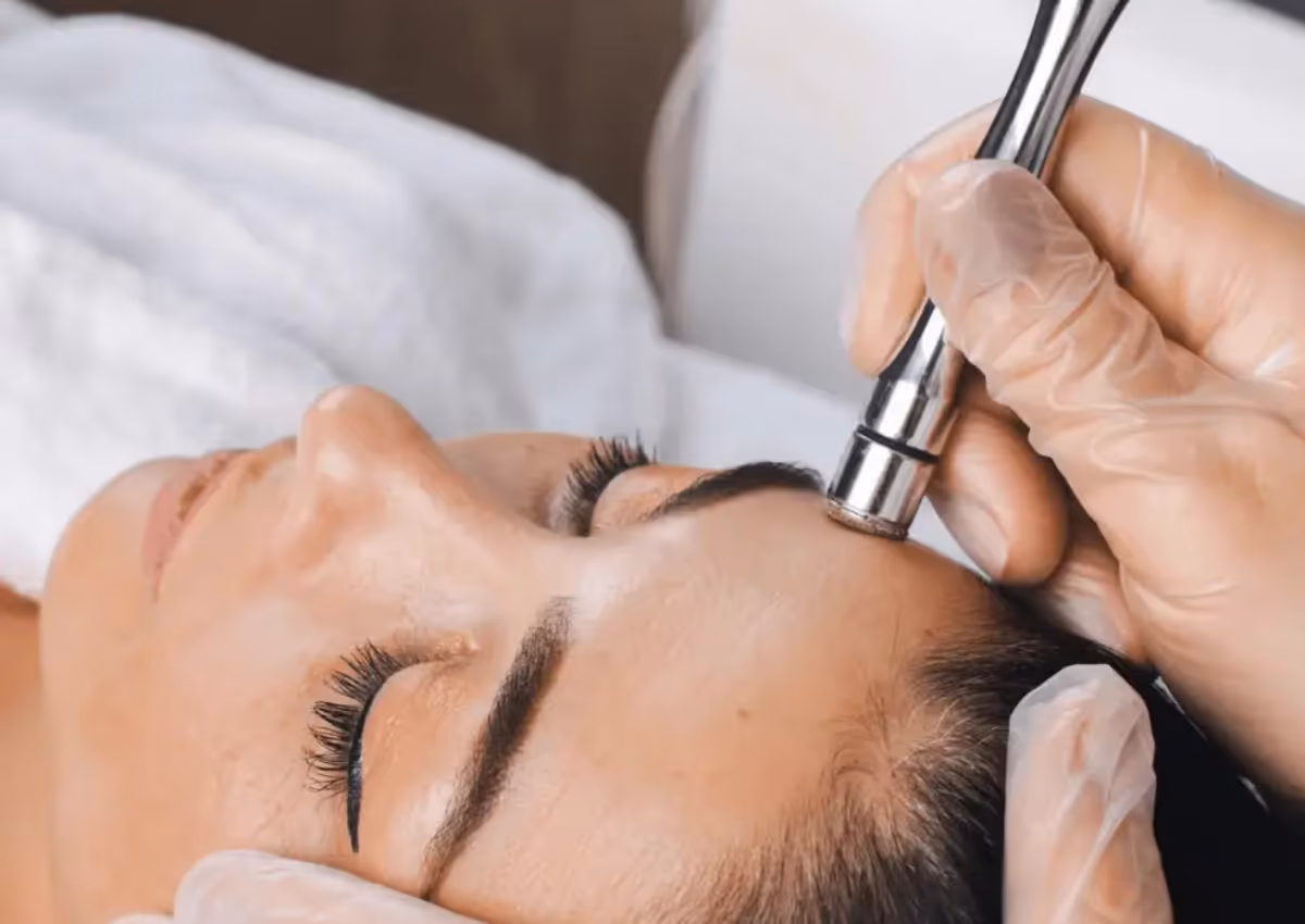Microdermabrasion Treatment in Las Vegas