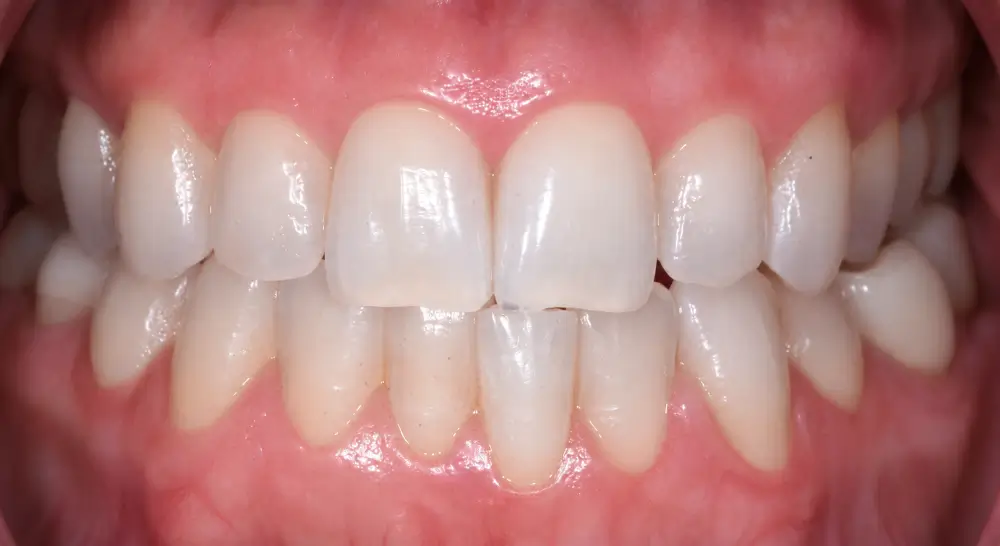 Before Image