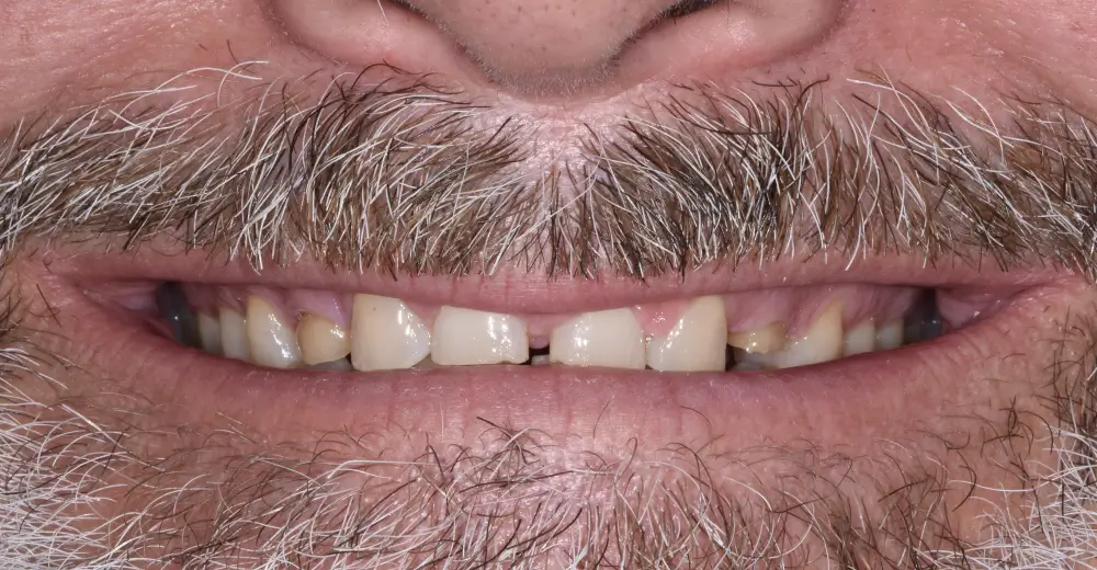 Before Image
