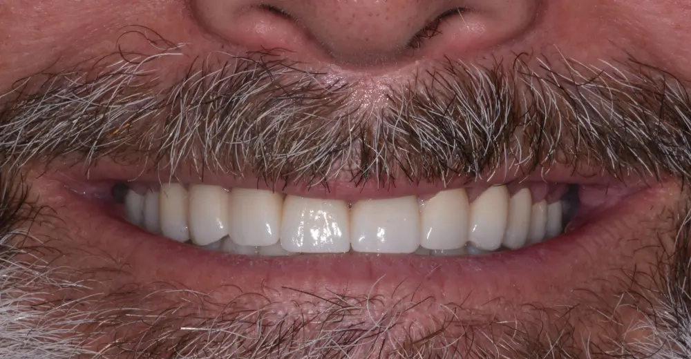After Image