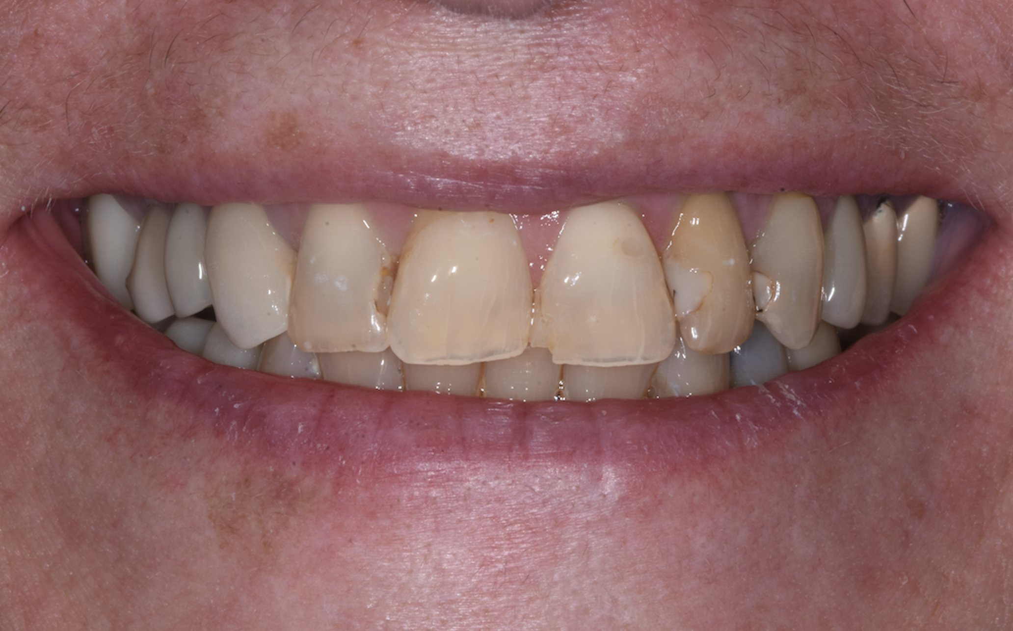 Before Image