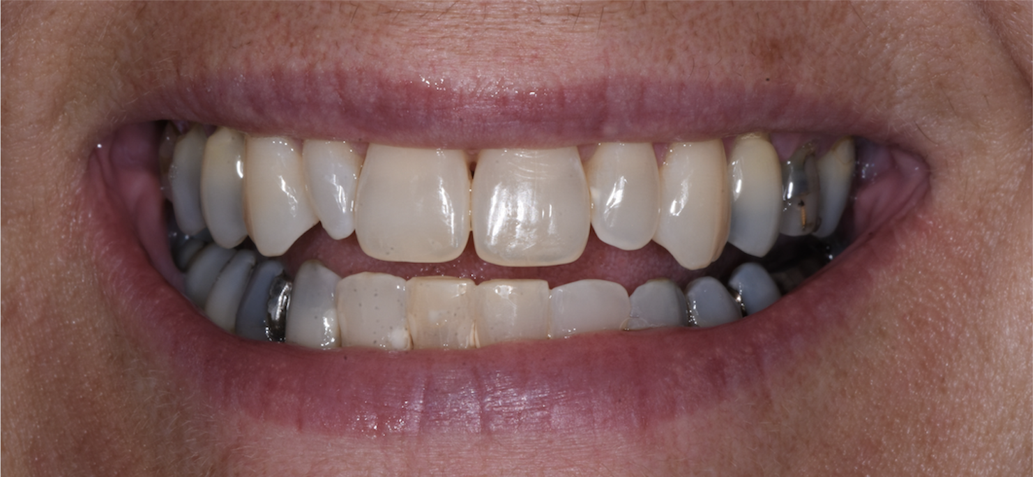 Before Image