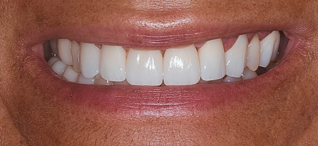 After Image