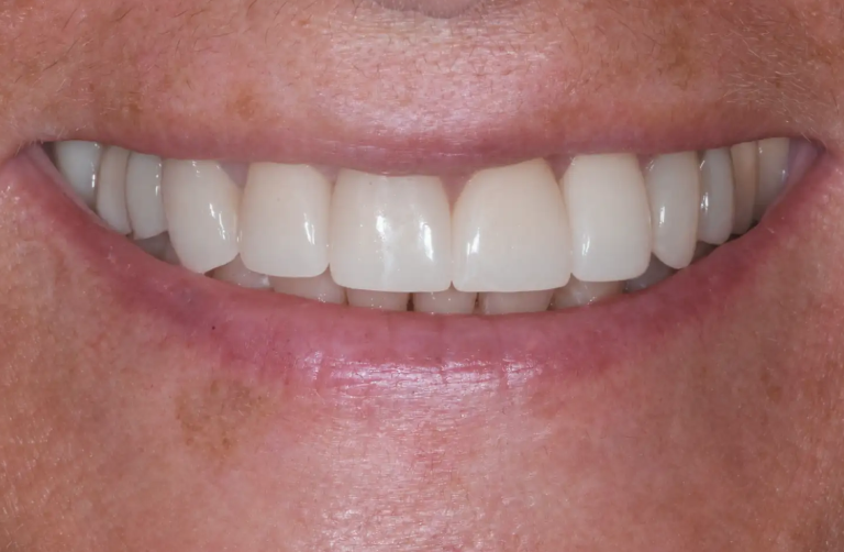 After Image