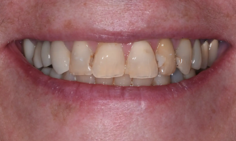 Before Image