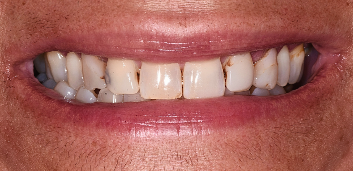 Before Image