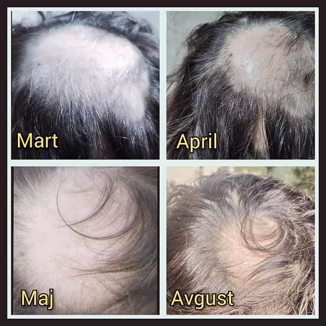 Rezultati prikazani na ženi