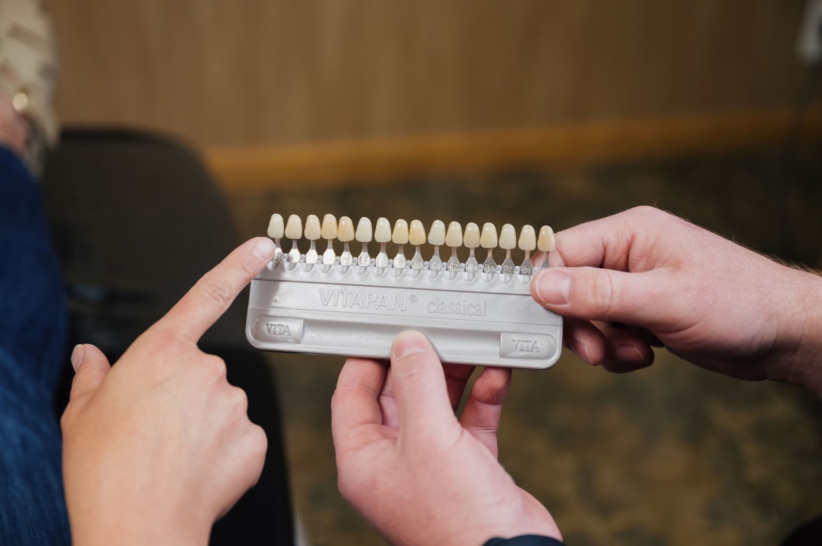 Patient and dentist comparing porcelain veneer shade samples during consultation.