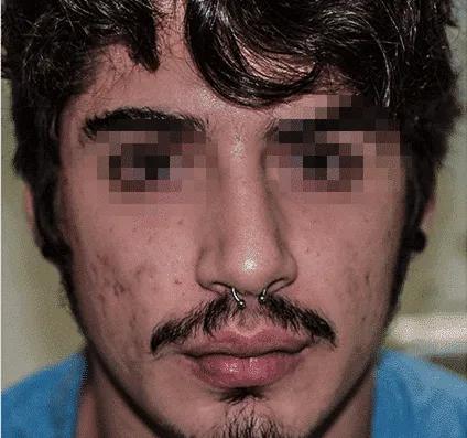 Before and after images