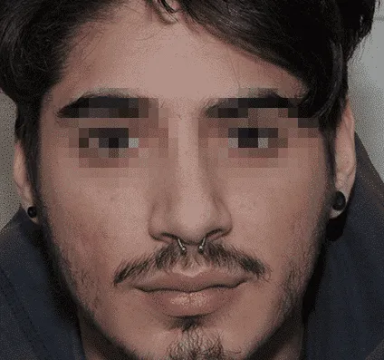 Before and after images