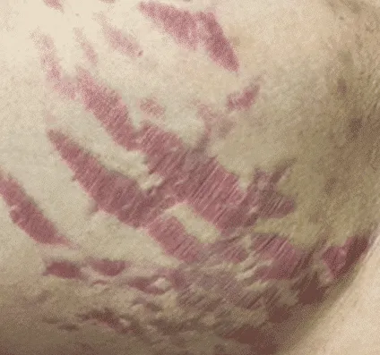 Before and after images