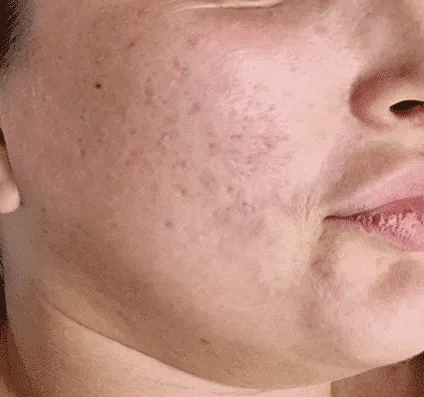 Before and after images